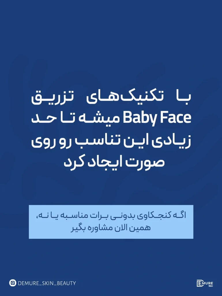 پست اینستاگرام